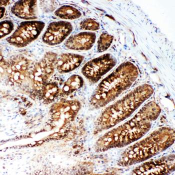 VCP Rabbit Polyclonal Antibody