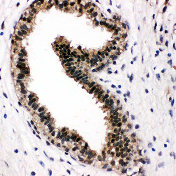 VCP Rabbit Polyclonal Antibody