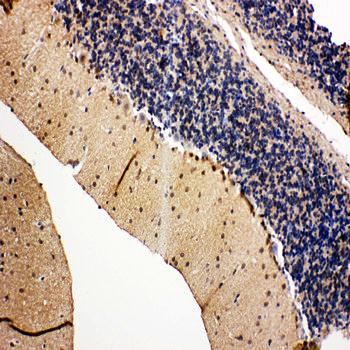 VCP Rabbit Polyclonal Antibody