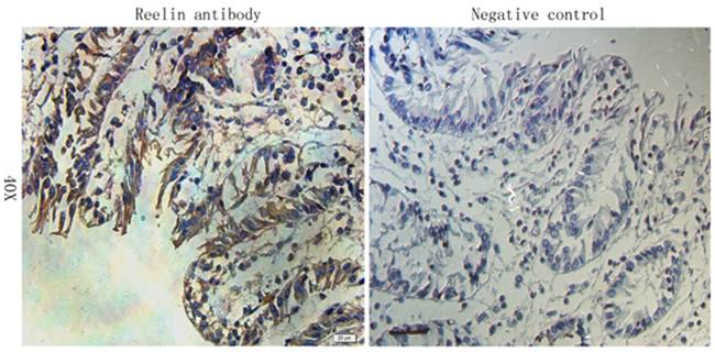 Reelin Rabbit Polyclonal Antibody