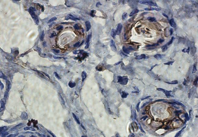 TIMP1 Rabbit Polyclonal Antibody