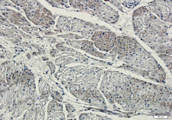 TIMP1 Rabbit Polyclonal Antibody