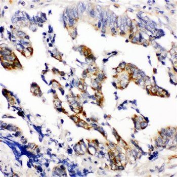 Beta Arrestin 2/ARRB2 Rabbit Polyclonal Antibody