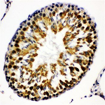Beta Arrestin 2/ARRB2 Rabbit Polyclonal Antibody