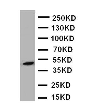 Beta Arrestin 2/ARRB2 Rabbit Polyclonal Antibody