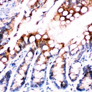 Fatty Acid Binding Protein 5/FABP5 Rabbit Polyclonal Antibody