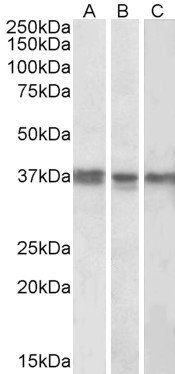 POLDIP2 Antibody