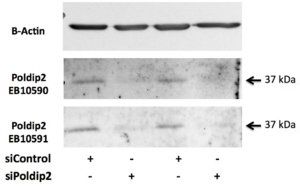 POLDIP2 Antibody