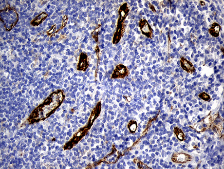 TSPAN7 Antibody