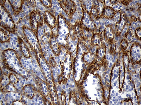 TSPAN7 Antibody