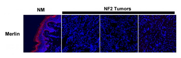 DDK Antibody