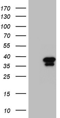 Gemin 8 Antibody