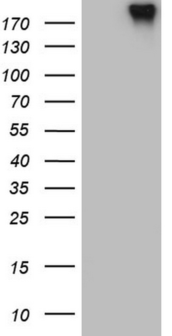 RET Antibody