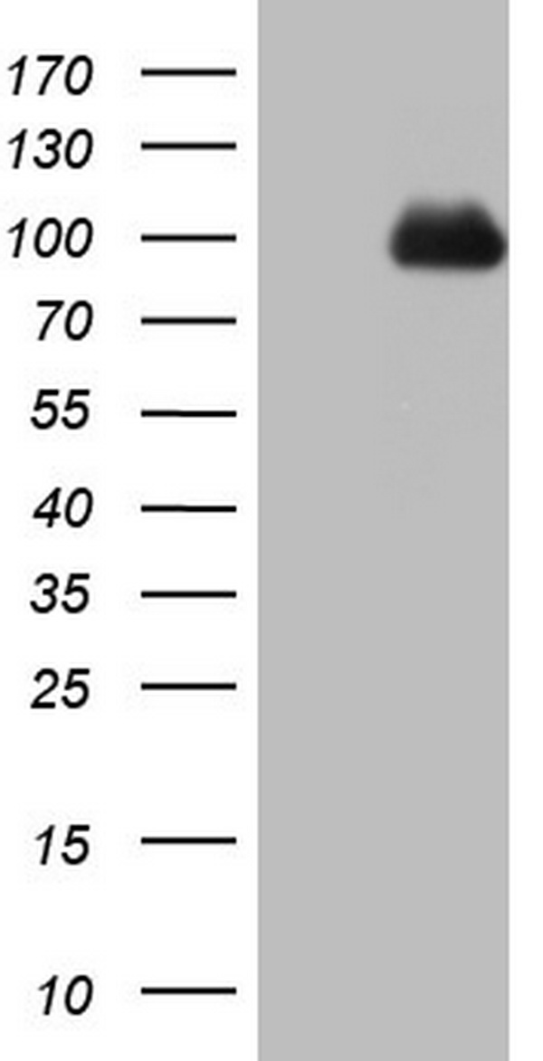 CD56 Antibody