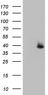 SAE1 Antibody
