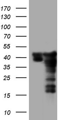 SAE1 Antibody