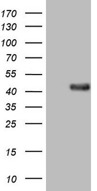 SAE1 Antibody