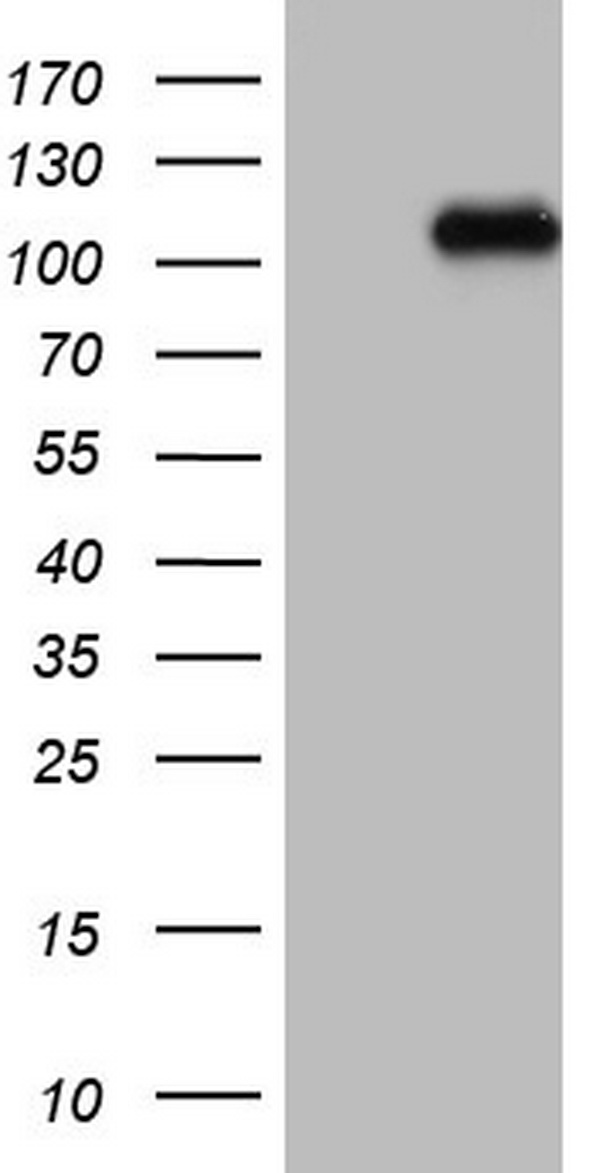 MCPH1 Antibody