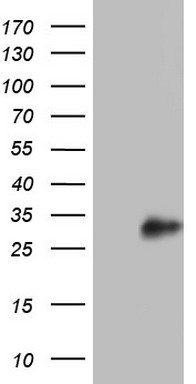 Adiponectin Antibody