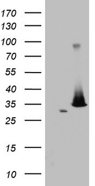 NIPP1 Antibody