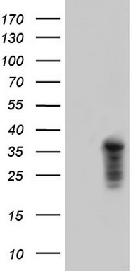 Cardiac Troponin T Antibody