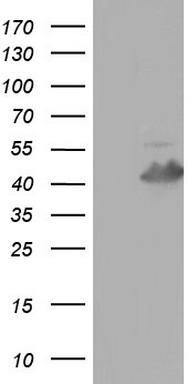 Cardiac Troponin T Antibody