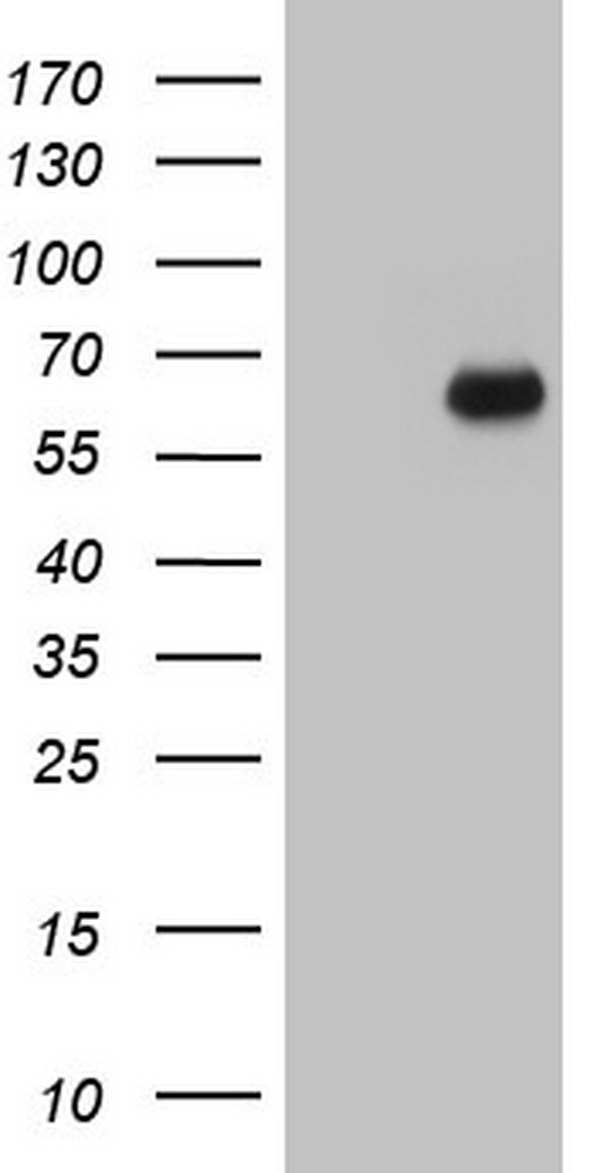 SMPD1 Antibody