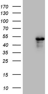 Cardiac Troponin T Antibody
