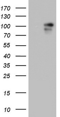 BFSP1 Antibody