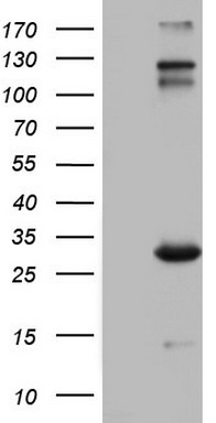 IGSF11 Antibody