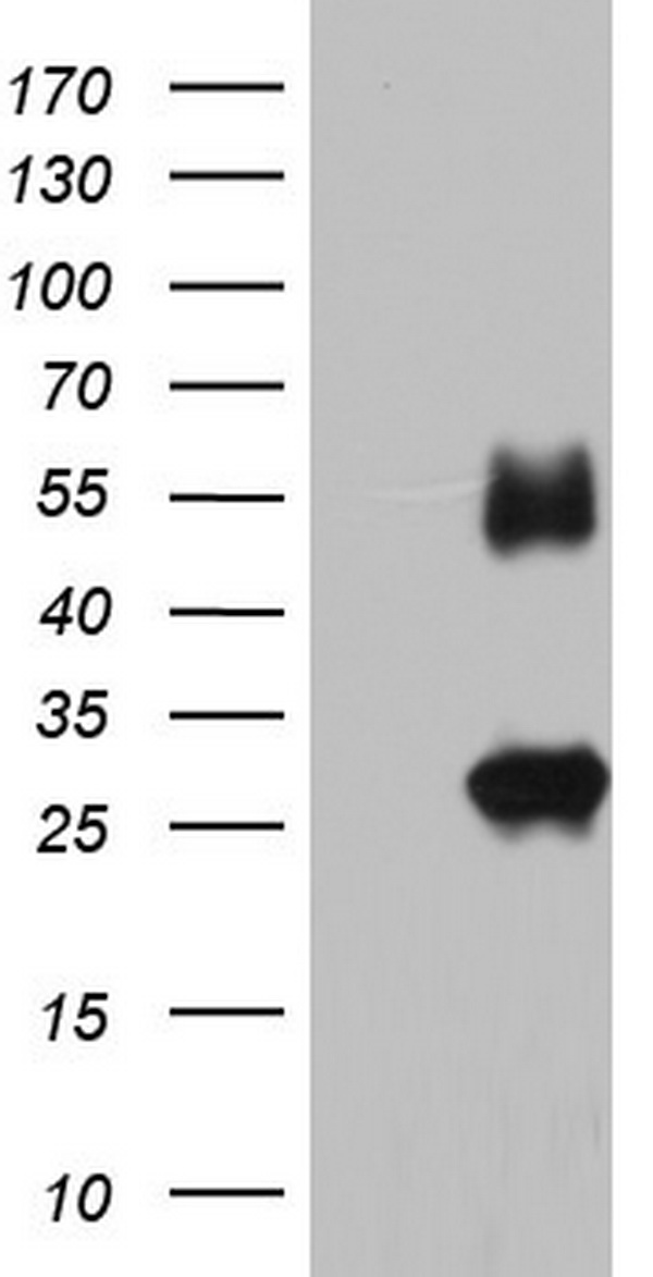 IGSF11 Antibody