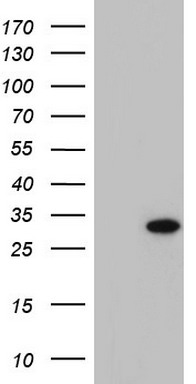 PRRX1 Antibody