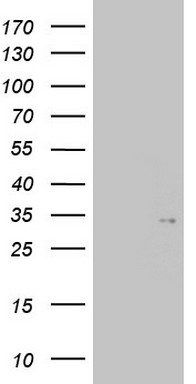 TGIF1 Antibody