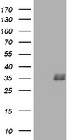TGIF1 Antibody