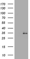 TGIF Antibody