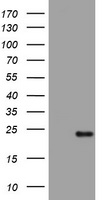 VILIP1 Antibody
