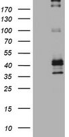 CD23 Antibody