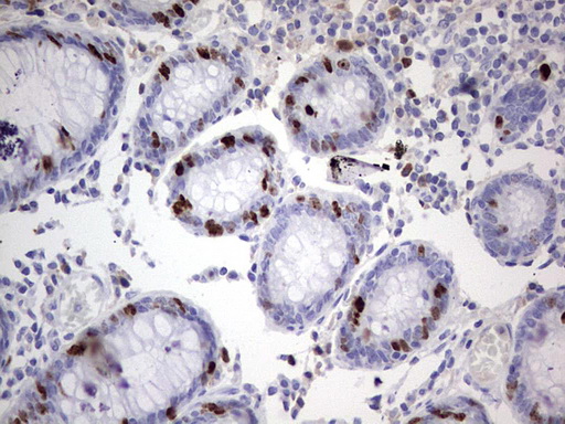 Ki67 Antibody