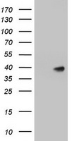 A4GNT Antibody