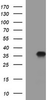PLPP1 Antibody