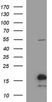 SIVA1 Antibody