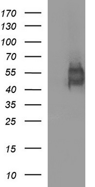 IL1R2 Antibody