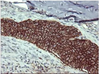 CD44 Antibody