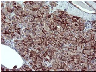 CD44 Antibody