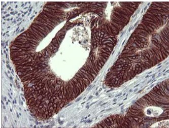 CD44 Antibody