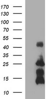 TNF Antibody
