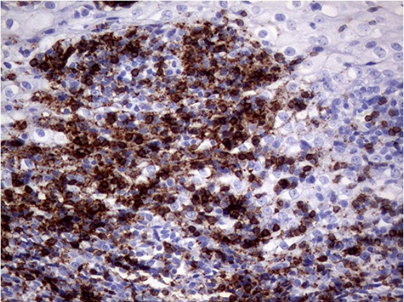 CD3E Antibody
