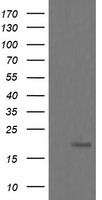 UBE2G2 Antibody