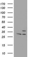 Proteasome 20S beta 7 Antibody