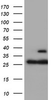 Proteasome 20S beta 7 Antibody